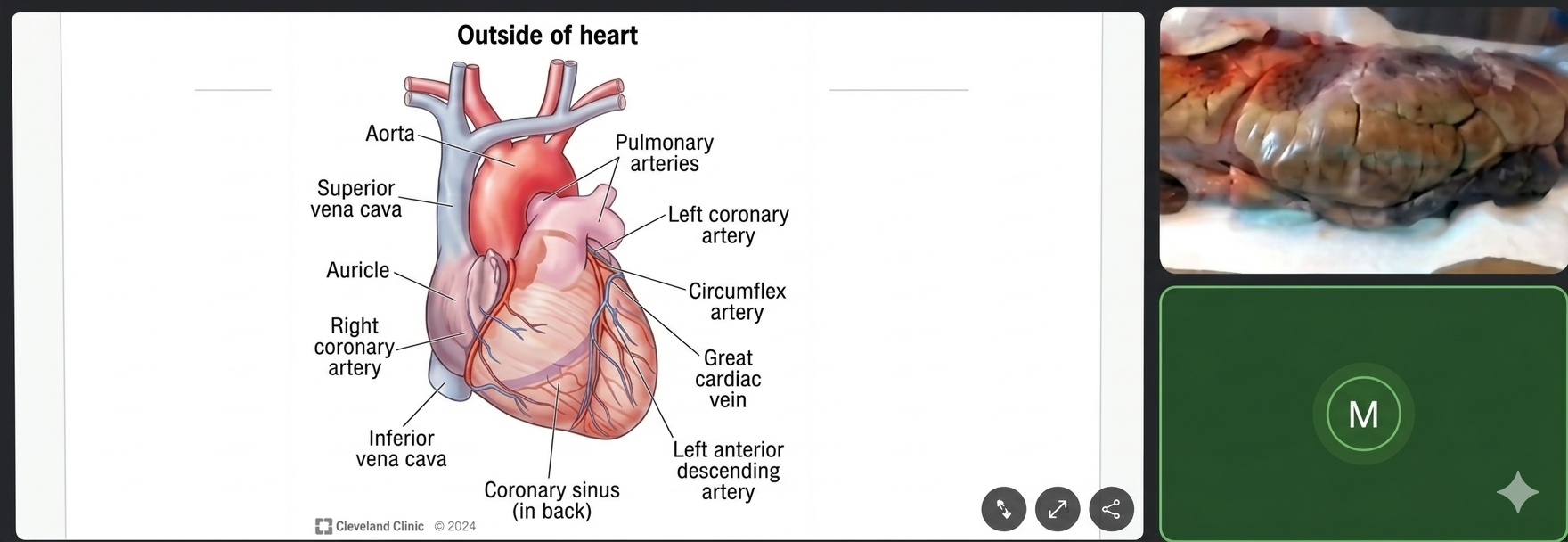 A virtual lesson showing heart anatomy on screen while the student holds a real cow heart